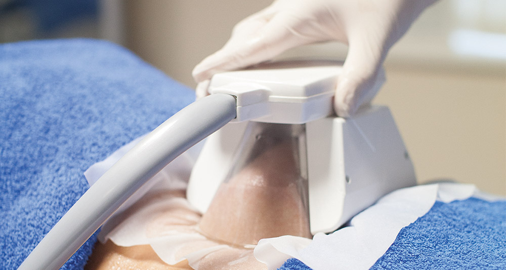 How Fat Freezing and HIFU Work Together? 2 Multiple Areas in One Session HIFU and Fat Freezing Broxburn