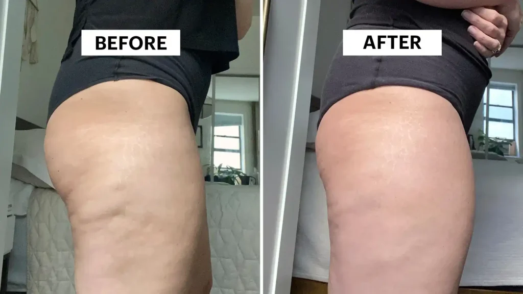 Do Toning Exercise Broxburn Really Tackle Cellulite?